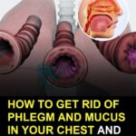 How to Get Rid of Phlegm and Mucus in Chest and Throat Naturally