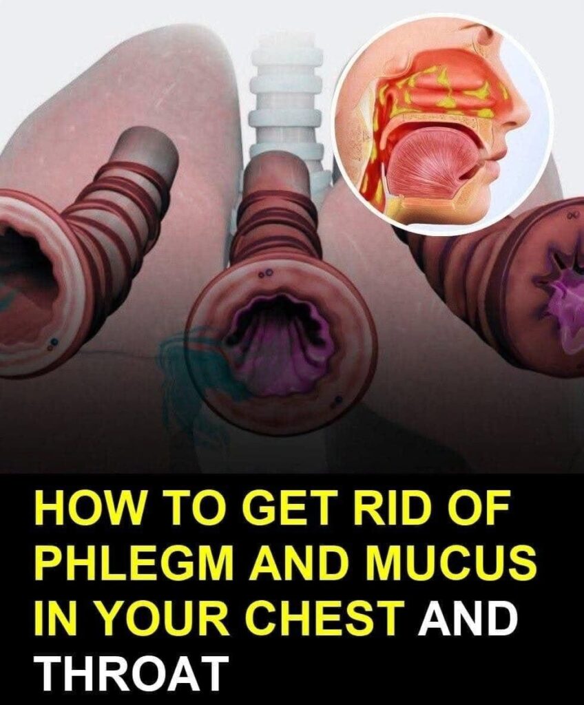 How to Get Rid of Phlegm and Mucus in Chest and Throat Naturally