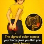You may have colon cancer if you…See More