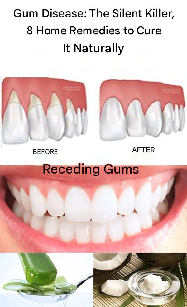 Gum disease: The silent killer, 8 home remedies to cure it naturally