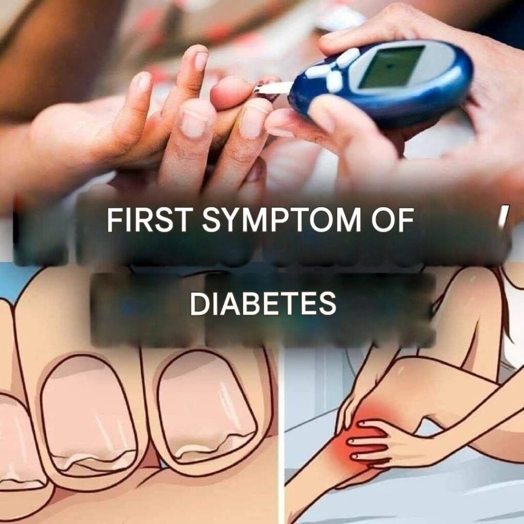 Here are the most surprising symptoms of diabetes (1/3)
