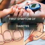 Here are the most surprising symptoms of diabetes (1/3)