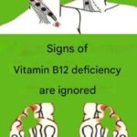 Signs of vitamin B12 deficiency are ignored