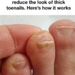 My nana swears by this trick to reduce the look of thick toenails. Here’s how it works