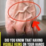 Did you know that having visible veins means you are… See more