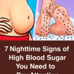 7 Nighttime Signs of High Blood Sugar You Should Never Ignore