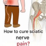 3 Exercises to Relieve Sciatica Pain in the Leg: Practical and Effective