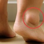 If your feet swell, it is a clear sign that