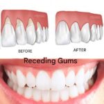 Gum disease: The silent killer, 8 home remedies to cure it naturally