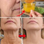 Bay Leaf 1,000,000× Stronger Than Botox – Erases ALL Wrinkles Even at The Age of 70 | Senior Health