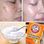How to Use Baking Soda to Remove Dark Spots, Wrinkles, and Dark Circles from Your Face