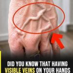 Did you know that having visible veins means you are… See more