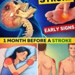 8 Warning Signs of Stroke That May Appear One Month Before and 9 Tips to Prevent It