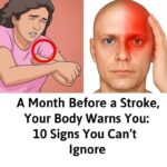 A month before a stroke, your body warns you: 10 signs not to ignore…