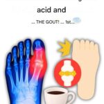 “My big toe was on fire… until I discovered these 5 drinks that naturally eliminate uric acid!”