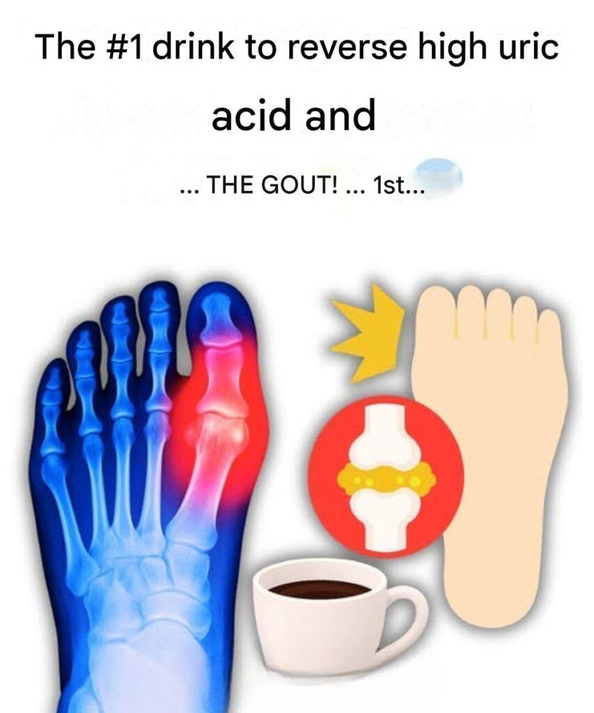 “My big toe was on fire… until I discovered these 5 drinks that naturally eliminate uric acid!”