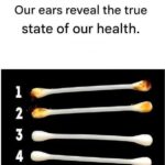 Our Ears Can Tell Us a Lot About Our Health